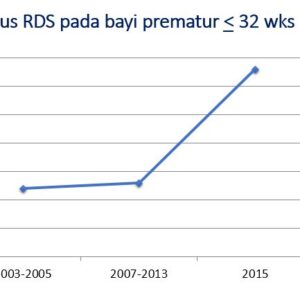 rds