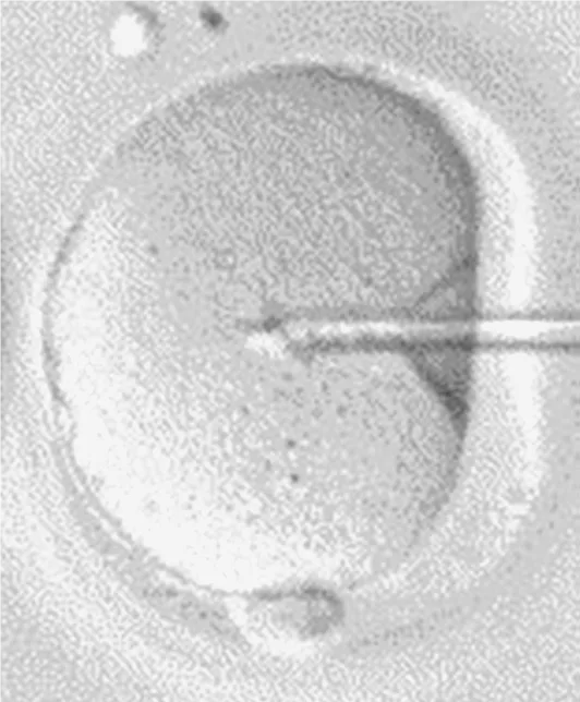 IVF