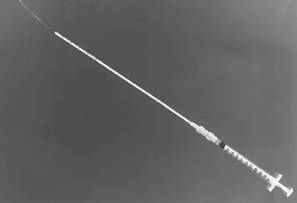 IVF